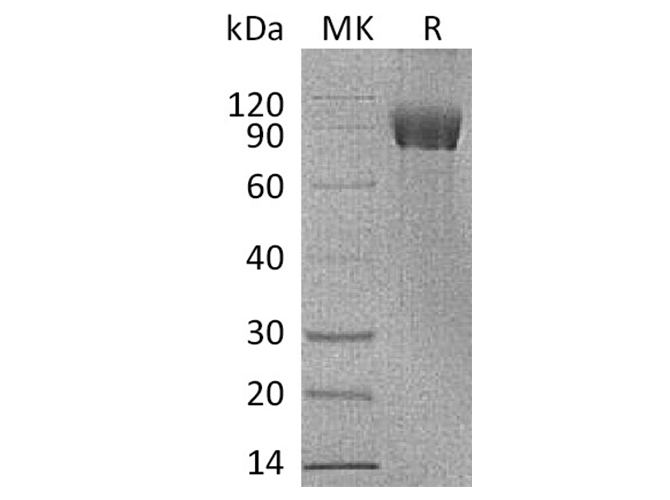 Recombinant Human IL-1R8/IL1RAPL1 Protein (Fc Tag) - ABMIUM