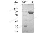 Recombinant Human LRG1 Protein (Fc & His Tag) - ABMIUM