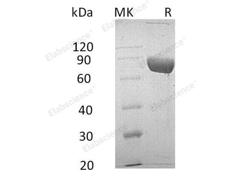 Recombinant Human LRG1 Protein (Fc & His Tag) - ABMIUM