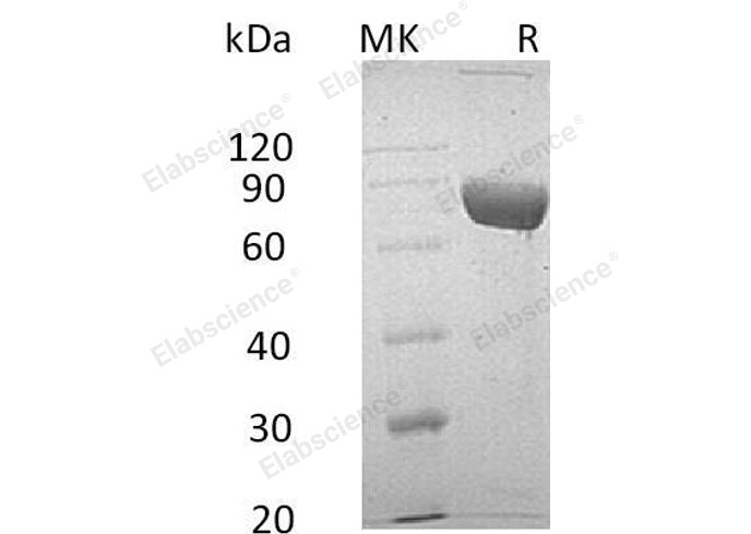 Recombinant Human LRG1 Protein (Fc & His Tag) - ABMIUM