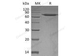 Recombinant Human ERO1A/ERO1L Protein (His Tag) - ABMIUM