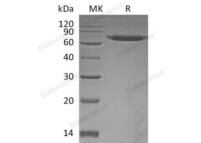 Recombinant Human ERO1A/ERO1L Protein (His Tag) - ABMIUM