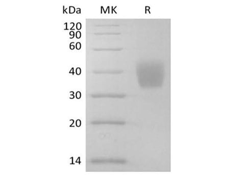 Recombinant Mouse IL-4RA (C-6His) - ABMIUM