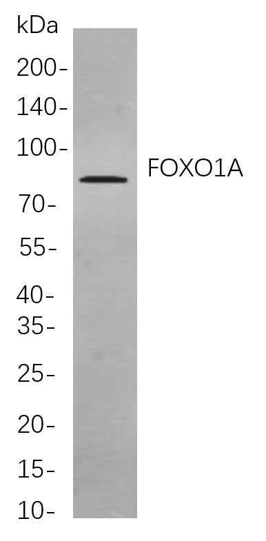 Anti-Human/Mouse FOXO1A Antibody [B809] - ABMIUM