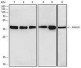 Anti-Human/Rat/Mouse RING1B Antibody [A531]