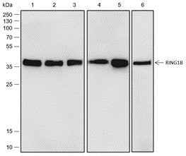 Anti-Human/Rat/Mouse RING1B Antibody [A531]