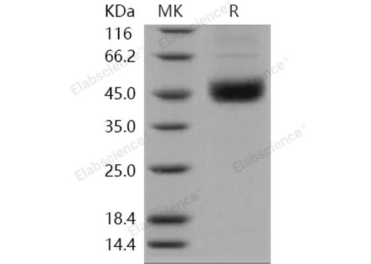 Recombinant Human SMYD2/KMT3C Protein (His Tag) - ABMIUM