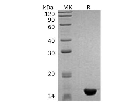 Recombinant Human MAP1LC3B Protein - ABMIUM