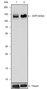 Anti-Human Phospho-SIRT1(Ser47) Antibody [A810] - ABMIUM