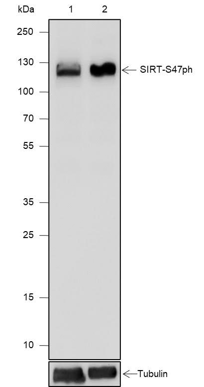 Anti-Human Phospho-SIRT1(Ser47) Antibody [A810] - ABMIUM