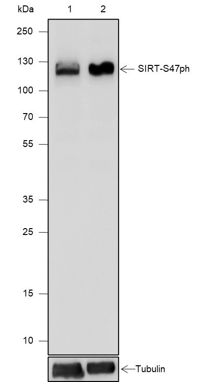 Anti-Human Phospho-SIRT1(Ser47) Antibody [A810] - ABMIUM