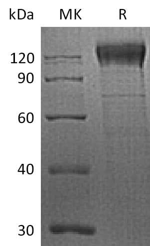 Recombinant Human Integrin Beta-1/ITGB1 (C-6His) - ABMIUM