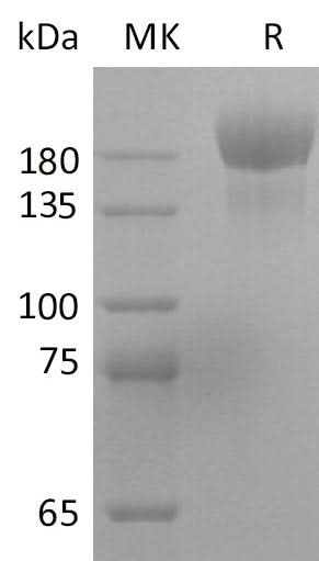 Recombinant SARS-CoV-2 S-trimer(D614G)(His Tag) - ABMIUM