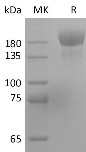 Recombinant SARS-CoV-2 S-trimer(D614G)(His Tag) - ABMIUM
