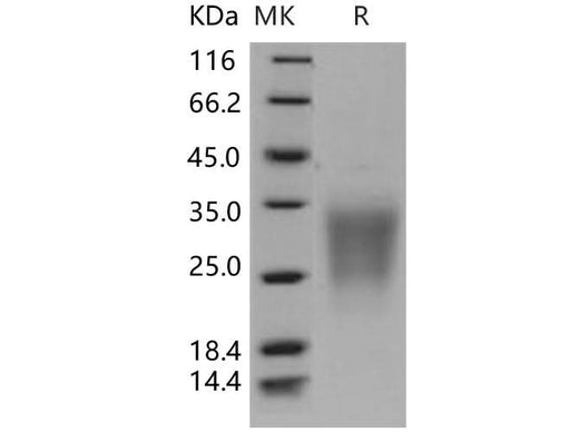 Recombinant Human SIGIRR/TIR8 Protein (His Tag) - ABMIUM