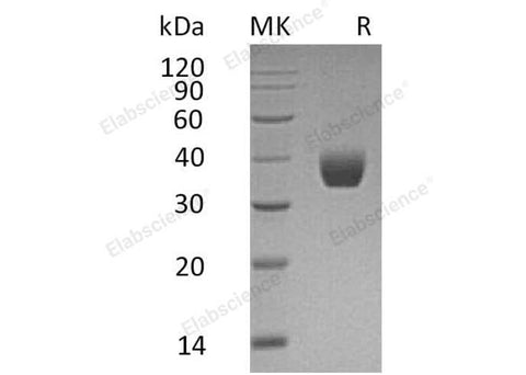 Recombinant Human PPT1 Protein (His Tag) - ABMIUM