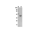 SDS-PAGE analysis of Human FGF21 proteins, 2 μg/lane of Recombinant Human FGF21 proteins was resolved with SDS-PAGE under reducing conditions, showing bands at 37 kDa.