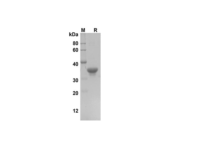 SDS-PAGE analysis of Human FGF21 proteins, 2 μg/lane of Recombinant Human FGF21 proteins was resolved with SDS-PAGE under reducing conditions, showing bands at 37 kDa.