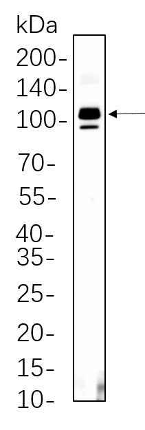 Anti-Human/Mouse/Rat SATB2 Antibody [B539] - ABMIUM