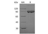Recombinant Mouse Transferrin Receptor/TFRC Protein (His Tag) - ABMIUM