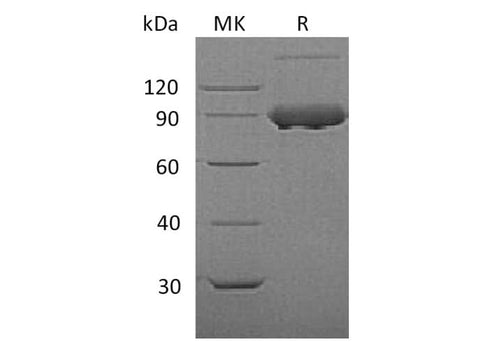 Recombinant Mouse Transferrin Receptor/TFRC Protein (His Tag) - ABMIUM