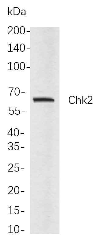 Anti-Human/Mouse/Rat Chk2 Antibody [B706]