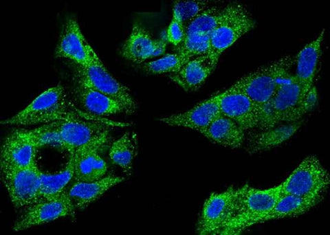 Anti-Human SULT1A1 Antibody [B156] - ABMIUM