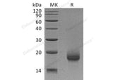 Recombinant Human LY6H Protein (His Tag) - ABMIUM