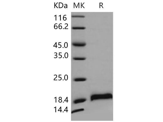 Recombinant Mouse CDNF/ARMETL1 Protein (His Tag) - ABMIUM