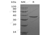 > 95 % as determined by reducing SDS-PAGE.