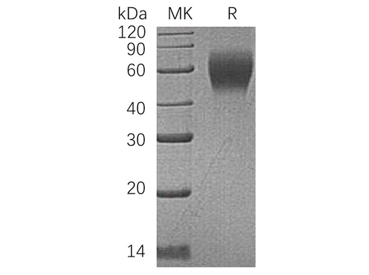 Recombinant Human CD200R1 Protein (His Tag) - ABMIUM
