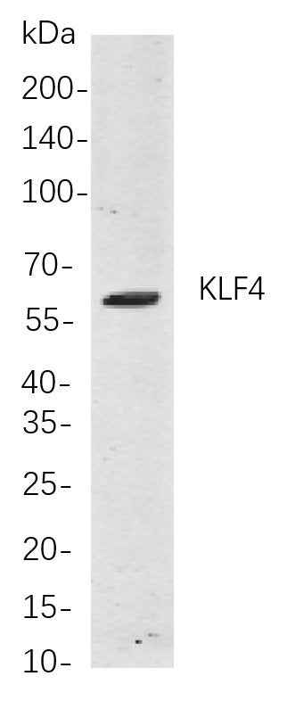 Anti-Human/Mouse/Rat KLF4 Antibody [B847] - ABMIUM