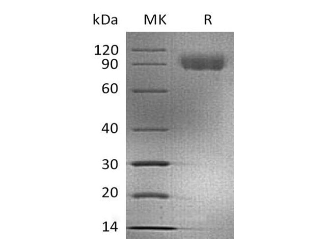 Recombinant Human CD155/PVR/NECL5 Protein (mFc Tag) - ABMIUM