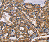 Anti-Human/Mouse/Rat EPHB6 Antibody - ABMIUM