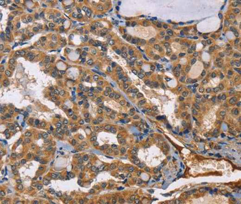Anti-Human/Mouse/Rat EPHB6 Antibody