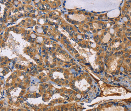 Anti-Human/Mouse/Rat EPHB6 Antibody - ABMIUM