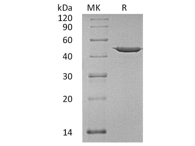 Recombinant Human Annexin A7/ANXA7 Protein - ABMIUM
