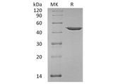 Recombinant Human Annexin A7/ANXA7 Protein - ABMIUM