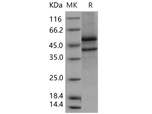 Recombinant Human SPOCK1/Testican 1 Protein (aa 21-429, His Tag) - ABMIUM