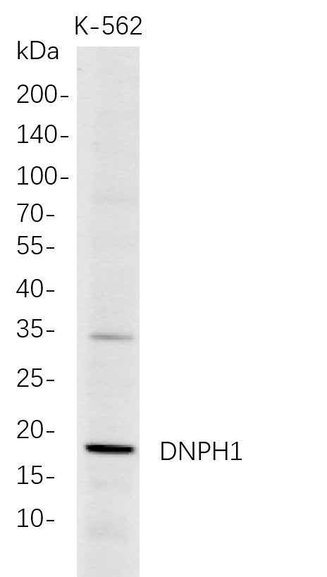 Anti-Human DNPH1 Antibody [B708] - ABMIUM