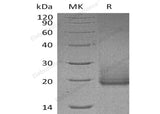 Recombinant Human Cryptic/CFC1 Protein (His Tag) - ABMIUM