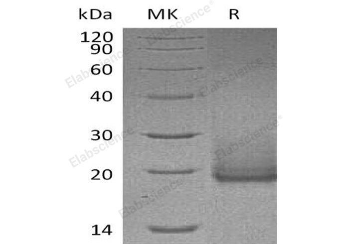 Recombinant Human Cryptic/CFC1 Protein (His Tag) - ABMIUM
