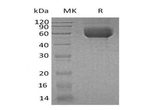Recombinant Human IL1RL1/ST2 Protein (His Tag) - ABMIUM