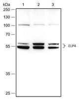 Anti-Human/Rat/Mouse ELP4 Antibody [A478]