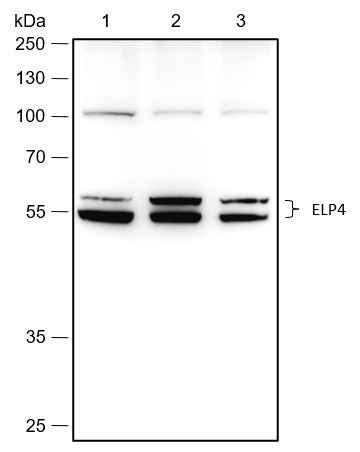 Anti-Human/Rat/Mouse ELP4 Antibody [A478]