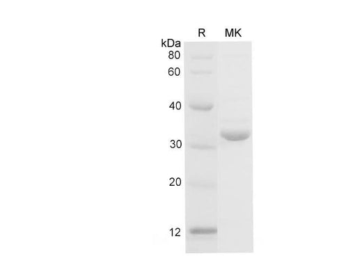 SDS-PAGE analysis of Mouse Galectin-3/Lgals3 proteins, 2 μg/lane of Recombinant Mouse Galectin-3/Lgals3 proteins was resolved with SDS-PAGE under reducing conditions, showing bands at 31-33 kDa.