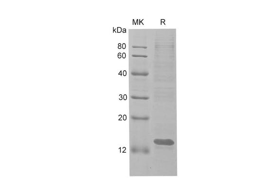 SDS-PAGE analysis of Human KI67 proteins, 2 μg/lane of Recombinant Human KI67 proteins was resolved with SDS-PAGE under reducing conditions, showing bands at 13 kDa.