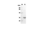 SDS-PAGE analysis of Human CXCL6/GCP-2 proteins , 2 μg/lane of Recombinant Human CXCL6/GCP-2 proteins was resolved with SDS-PAGE under reducing conditions , showing bands at 30 kDa.