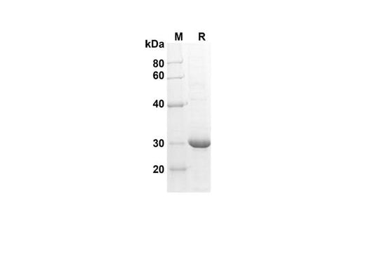 SDS-PAGE analysis of Human CXCL6/GCP-2 proteins , 2 μg/lane of Recombinant Human CXCL6/GCP-2 proteins was resolved with SDS-PAGE under reducing conditions , showing bands at 30 kDa.