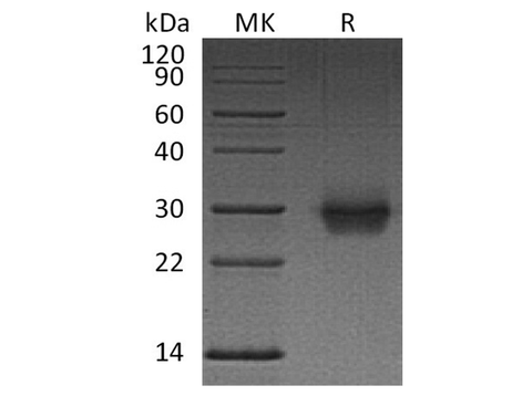 Recombinant Human CD40/TNFRSF5 Protein (His Tag) - ABMIUM